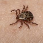 Wood tick on human body